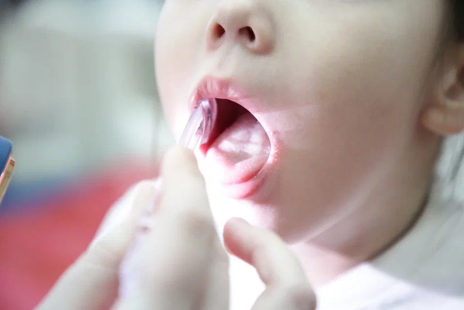 Баланың тісі неге ерте жастан бүлінеді?