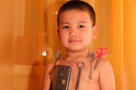 «Магнит» баланың бүгінгі жағдайы қандай?