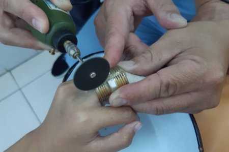 Дәрігерлер баланың саусағына кептеліп қалған болтты кесіп алды