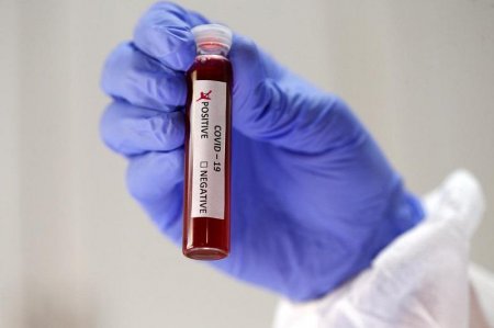 Елімізде 21 адам коронавирус жұқтырды: Жалпы 423 адам індетке шалдыққан