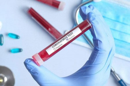 Мемлекеттік бас санитар шектеу шаралары күшейтілуі тиіс өңірлерді атады